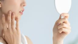 鏡を見るたびに落ち込んで…。再発と治療をくり返しながら仕事をつづける【人前に出る仕事だからこその苦悩と選択・後編】